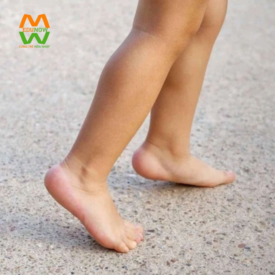 Dáng đi của trẻ tự kỷ