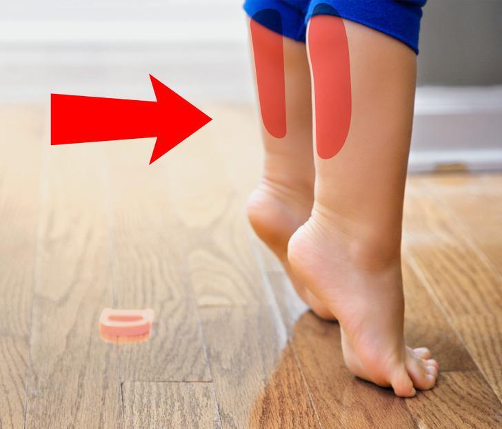 trẻ đi nhón chân là tự kỷ 